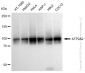 KD-Validated Anti-ATP2A2 Rabbit Monoclonal Antibody