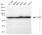 KD-Validated Anti-DDX5 Rabbit Monoclonal Antibody