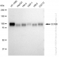 KD-Validated Anti-CD166 Rabbit Monoclonal Antibody