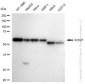 KD-Validated Anti-EOGT Rabbit Monoclonal Antibody