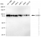 KD-Validated Anti-CSDE1 Rabbit Monoclonal Antibody