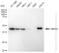 KD-Validated Anti-ABHD5 Rabbit Monoclonal Antibody