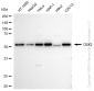 KD-Validated Anti-CBX2 Rabbit Monoclonal Antibody