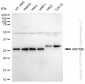 KD-Validated Anti-ANP32B Rabbit Monoclonal Antibody