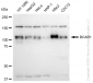 KD-Validated Anti-BCAR1 Rabbit Monoclonal Antibody