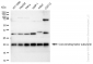 KD-Validated Anti-Core-binding factor subunit beta Rabbit Monoclonal Antibody