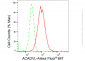 KD-Validated Anti-ACADVL Rabbit Monoclonal Antibody