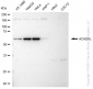 KD-Validated Anti-ACADVL Rabbit Monoclonal Antibody