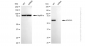 KD-Validated Anti-ACADVL Rabbit Monoclonal Antibody