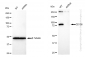 KD-Validated Anti-CD105 Rabbit Monoclonal Antibody