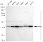KD-Validated Anti-ERK1 Rabbit Monoclonal Antibody