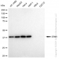 KD-Validated Anti-ERK1 Rabbit Monoclonal Antibody