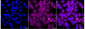 KD-Validated Anti-PFKM Rabbit Monoclonal Antibody