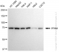 KD-Validated Anti-PFKM Rabbit Monoclonal Antibody