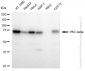 KD-Validated Anti-PKC delta Rabbit Monoclonal Antibody