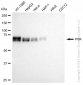 KD-Validated Anti-PVR Rabbit Monoclonal Antibody