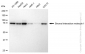 KD-Validated Anti-Stromal interaction molecule 1 Rabbit Monoclonal Antibody