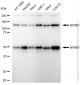 KD-Validated Anti-NFKB1 Rabbit Monoclonal Antibody