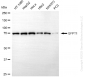 KD-Validated Anti-GFPT1 Rabbit Monoclonal Antibody