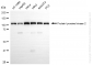 KD-Validated Anti-Protein Tyrosine Kinase 2 Rabbit Monoclonal Antibody