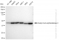 KD-Validated Anti-Acetyl-CoA acyltransfe rase 2 Rabbit Monoclonal Antibody