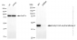 KD-Validated Anti-Acetyl-CoA acyltransfe rase 2 Rabbit Monoclonal Antibody
