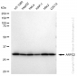 KD-Validated Anti-ARPC2 Rabbit Monoclonal Antibody