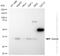 KD-Validated Anti-Desmin Rabbit Monoclonal Antibody