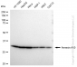 KD-Validated Anti-Annexin A10 Rabbit Monoclonal Antibody