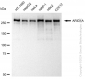 KD-Validated Anti-ARID1A Rabbit Monoclonal Antibody