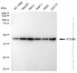 KD-Validated Anti-ATG4B Rabbit Monoclonal Antibody