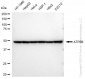 KD-Validated Anti-ATP5B Rabbit Monoclonal Antibody