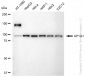 KD-Validated Anti-AP1G1 Rabbit Monoclonal Antibody