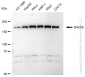 KD-Validated Anti-BAZ1B Rabbit Monoclonal Antibody