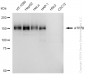 KD-Validated Anti-ATP7B Rabbit Monoclonal Antibody