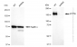 KD-Validated Anti-ATP7B Rabbit Monoclonal Antibody