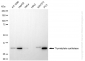 KD-Validated Anti-Thymidylate Synthase Rabbit Monoclonal Antibody
