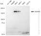 KD-Validated Anti-IQGAP2 Rabbit Monoclonal Antibody