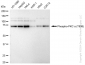 KD-Validated Anti-Phospho-PKC alpha (T638) Rabbit Monoclonal Antibody