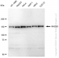 KD-Validated Anti-RAD50 Rabbit Monoclonal Antibody