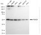 KD-Validated Anti-PSMD4 Rabbit Monoclonal Antibody