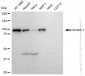 KD-Validated Anti-Sortilin 1 Rabbit Monoclonal Antibody