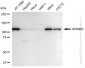 KD-Validated Anti-SPINK5 Rabbit Monoclonal Antibody