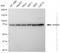 KD-Validated Anti-VPS35 Rabbit Monoclonal Antibody