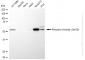 KD-Validated Anti-Phospho-Vimentin (Ser72) Rabbit Monoclonal Antibody