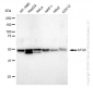 KD-Validated Anti-ATG5 Rabbit Monoclonal Antibody