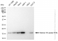 KD-Validated Anti-Histone H3 (acetyl K18) Rabbit Monoclonal Antibody