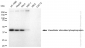 KD-Validated Anti-Vasodilator stimulated phosphoprotein Rabbit Monoclonal Antibody