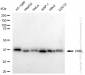 KD-Validated Anti-CRKL Rabbit Monoclonal Antibody