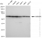 KD-Validated Anti-HNRNPK Rabbit Monoclonal Antibody